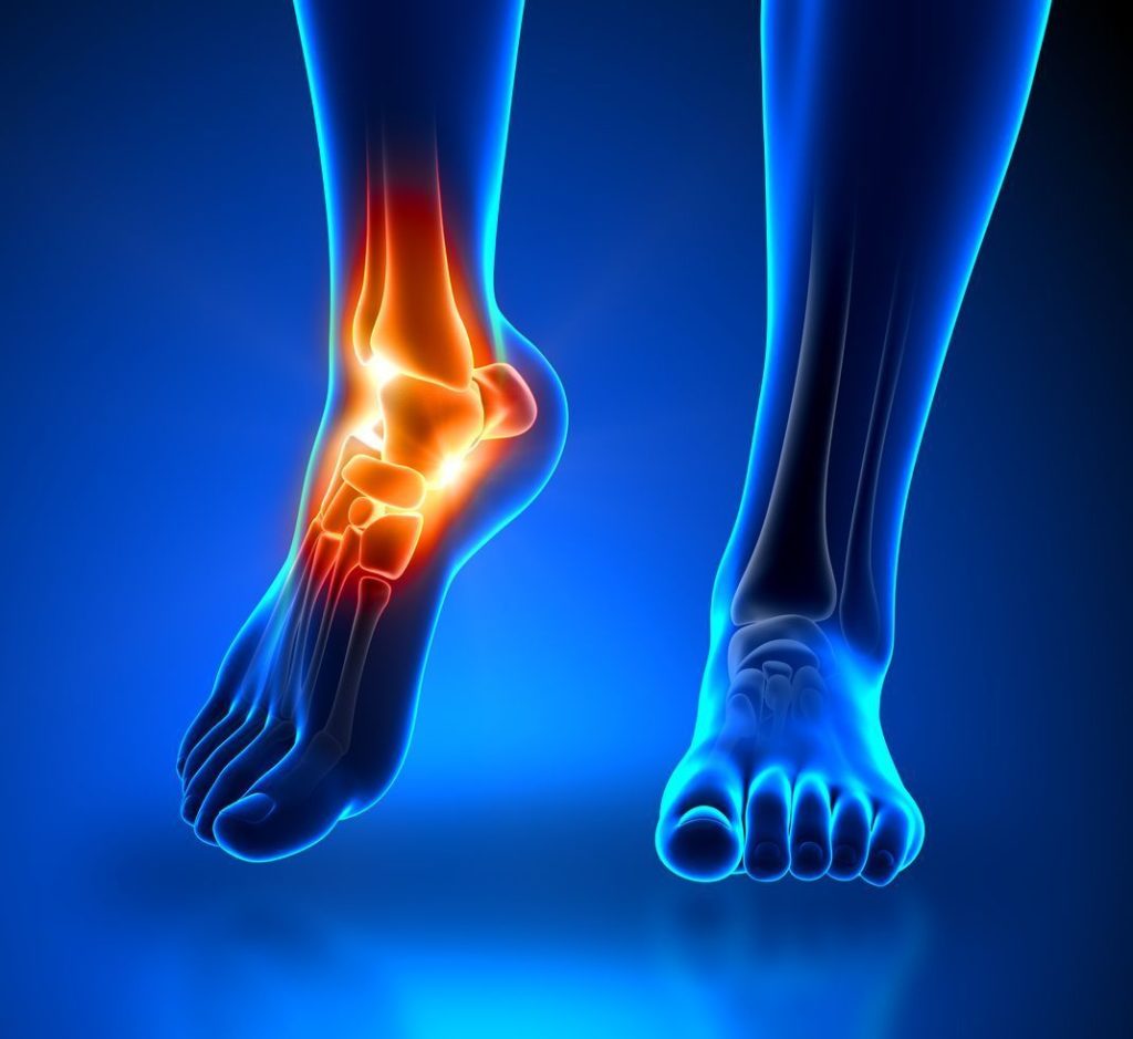 Physical therapy for foot injury recovery