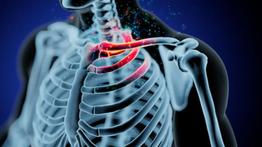 thoracic outlet syndrome nerve compression diagnosed with EMG Chicago